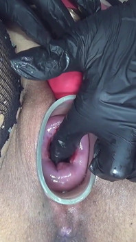 Cervix Check