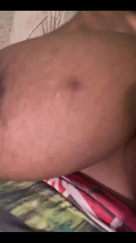 25460764