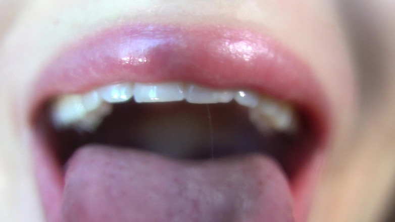 Rarible Diamond: 사용자 정의 위에 입술