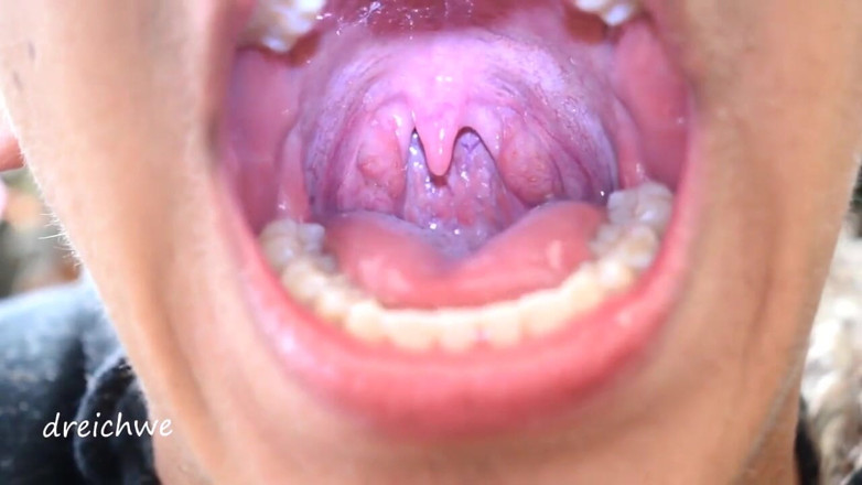 Dreichwe: Uvula fetisch-mund