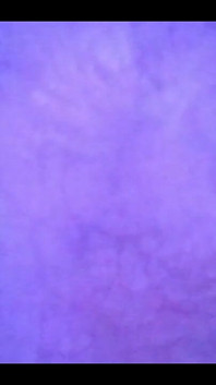 Beautiful Inside POV of My Full Bladder with the Endoscope!