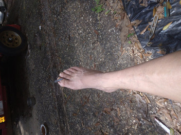 MrLeggs: 肉と足。ナッツとお尻。a フリーク・オー・ナチュラル アーチとあまりでんぷんのない完全なもの