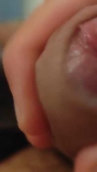Un Grand Phimosis Gênant L’orgasme Du Garçon.