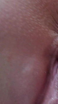 Asshole Closeup