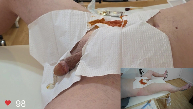 Clinical Climax: Wkładanie cewnika