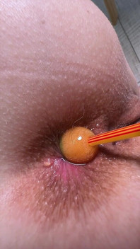 He Inflated My Ass Like a Sail! the Anal Opened and He Smelled the Food He Treated Me to at the Cafe Today.