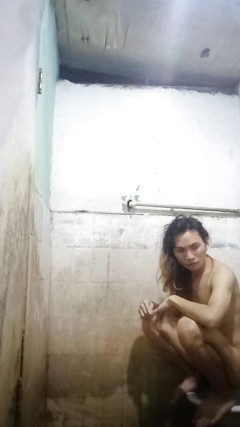 Because the Person Is Kind Because It Is Very Itchy thumbnail