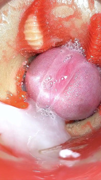 Telecamera in Anale Cervix POV, Piccolo Cornuto Da 'coppia' Gigante, Sborra in Anale E Creampie - Asmr