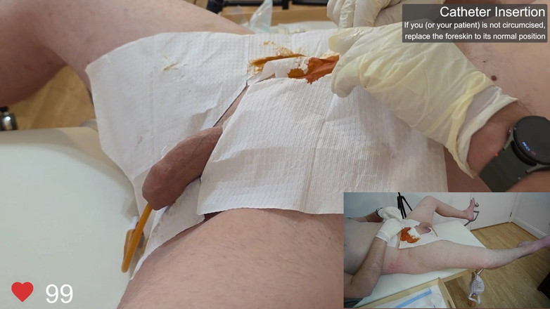 Clinical Climax: Kateter sokma