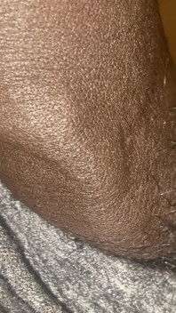 Meat Teaser
