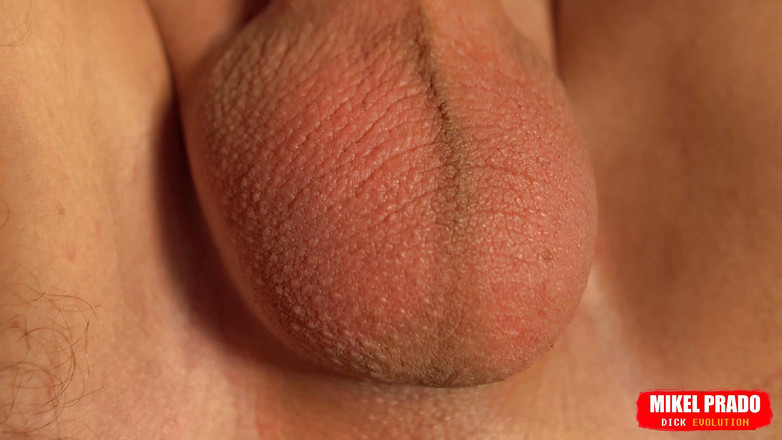 Mikel Prado: Crop bald eggs movement