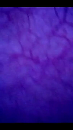 Beautiful Inside POV of My Full Bladder with the Endoscope!