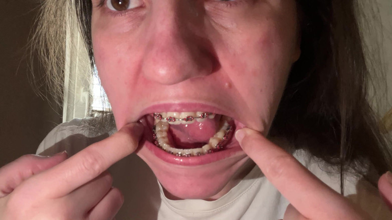 NicoleRay: Lingând aparatul dentar cu limba