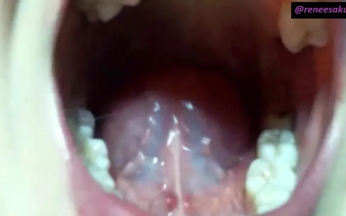 Renee Sakuya: Upclose Inside My Mouth