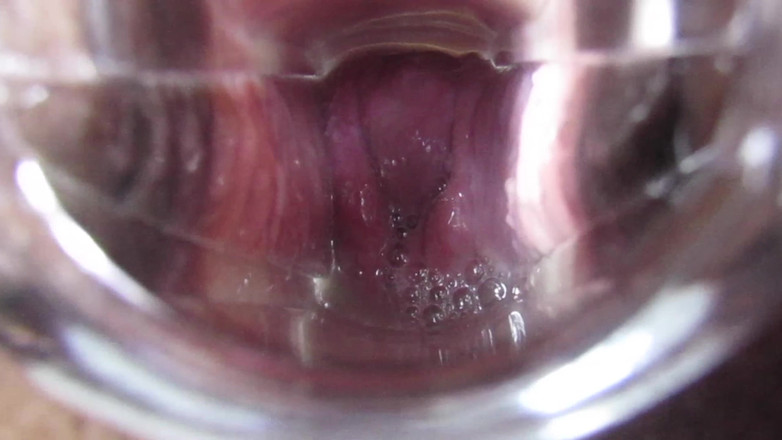 VeeVee Vixen: Cum Cervix Insemination