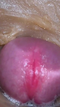คัมเฟตี้ ครีมพายไหลย้อย คอมไพล์ - มุมกล้องส่องกล้องภายใน