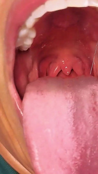Feticismo boccale, uvula vicina, mi strozzo con un BBC duro
