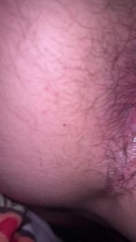 Bruised Asshole