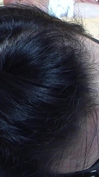 ใส่ไนลอน อ้าปากใส่ลูกบอล ถูกรัดมัดแน่น