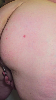 La Matrigna Torna a Casa Dalla Festa E Fammi Scopare Il Suo Sesso Anale