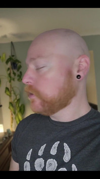 And as Always, It'll Grow Back