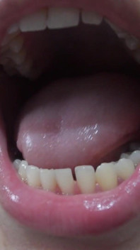 My Indian Stepsister Show Me Inside Her Mouth Her Tongue and Teeth