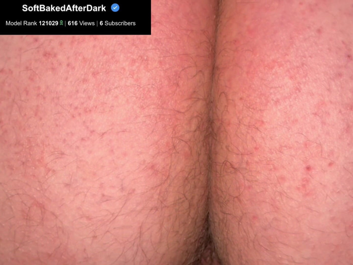 SoftBakedAfterDark: Culo peloso e grasso
