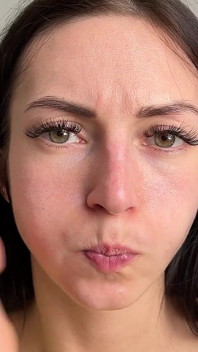 Puffy Cheeks Popping