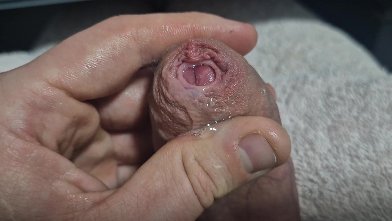 GloomyChase977: Sem cortes apertado Phimosis Cock Foreskin esticado close-up