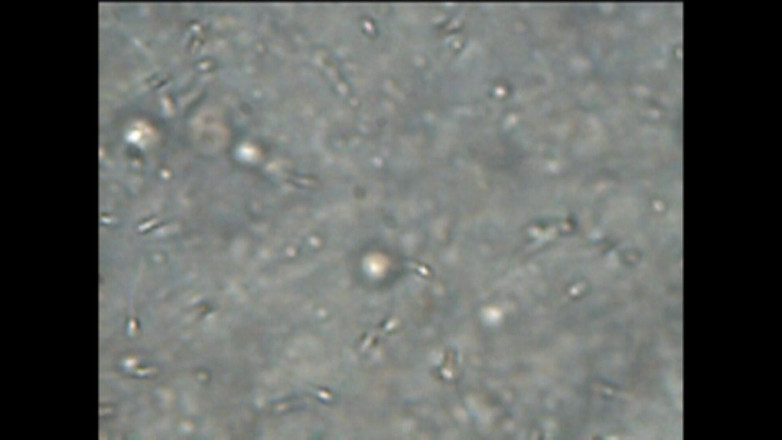 Mark Hannes: Fleshlight - masturbare și spermă la microscop