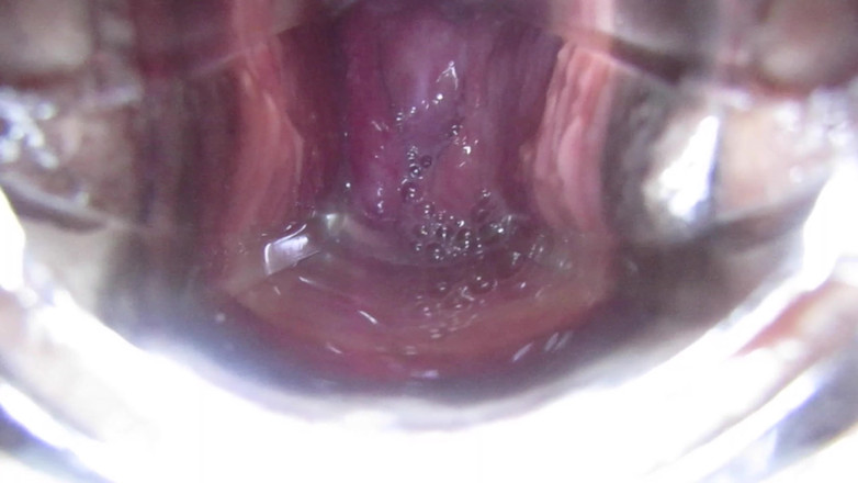 VeeVee Vixen: Výstřik děložního čípku Inseminace