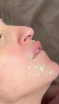 İkinci Meni Yükünün Alınması