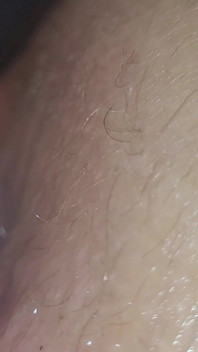 Caping Hole