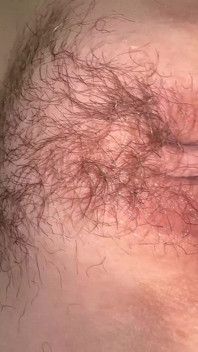 Small 18 Years Old Girl Looses Her Virginity, Her Tight Hole Takes Cum and She Gets Pregnant.