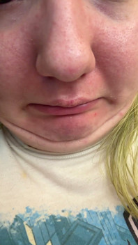 Chin Faces
