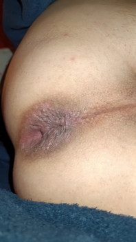 My Anus