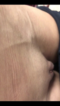 Someone Special Requested My Veins