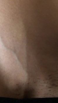 Abs Veins