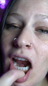Tour de boca con dentaduras postizas