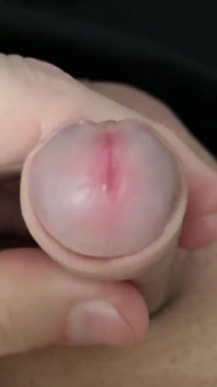 Small Forskin Penis