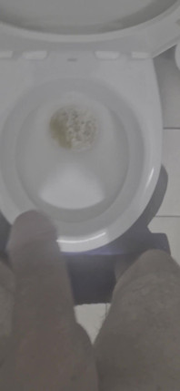 Peepeepee