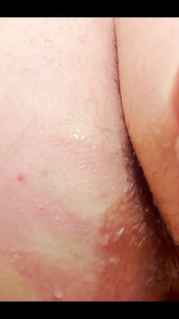 After Anal Sex This Dilated, My Ass Is Left Like This