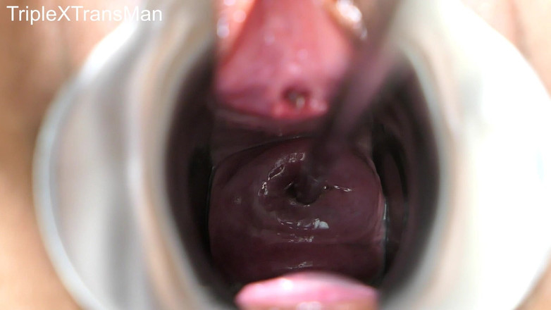 TripleXTransMan: Penetrace mého děložního čípku!