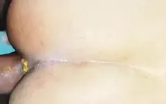 Anal Sex Hurts Me More