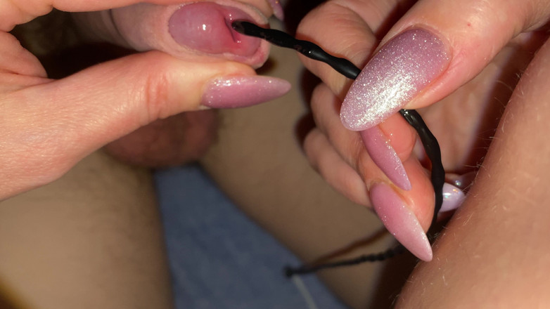 Hairy couple: For the First Time an Urogenital Probe Is Inserted Into...