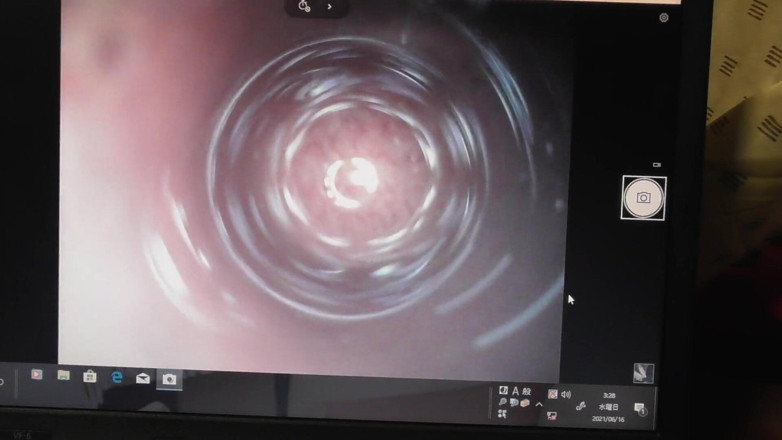 Osiritikubi: Miré el agujero de mi trasero con un endoscopio.