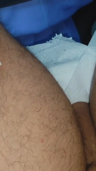The Dick Had to Be Implanted Slowly.