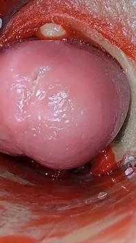 Camera Inside Deep Pussy Captures Overdose Ejaculation of Sperm Asmr