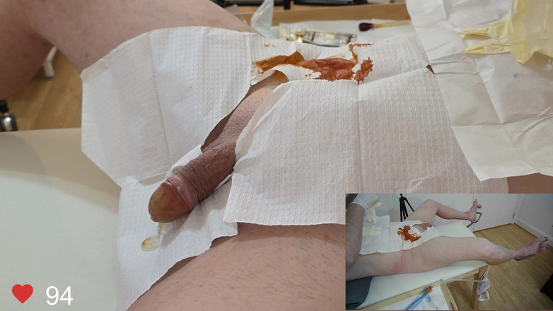 Clinical Climax: Введение катетера