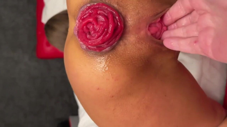 Monika Fox: Hard fisting and prolapse from a hot bitch Monika Fox...